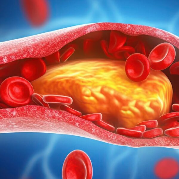 High Cholesterol Management: The Role of Walking in Reducing Bad Fats