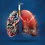 No Smoking Day: Smoking damages the lungs, know the preventive measures